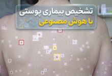 تشخیص بیماری پوستی با هوش مصنوعی