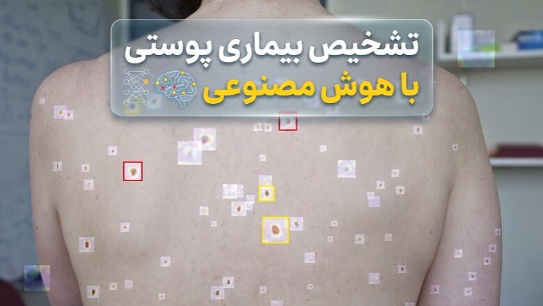 تشخیص بیماری پوستی با هوش مصنوعی