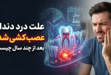 علت درد دندان عصب‌ کشی‌ شده